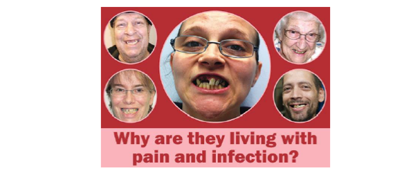 dental health